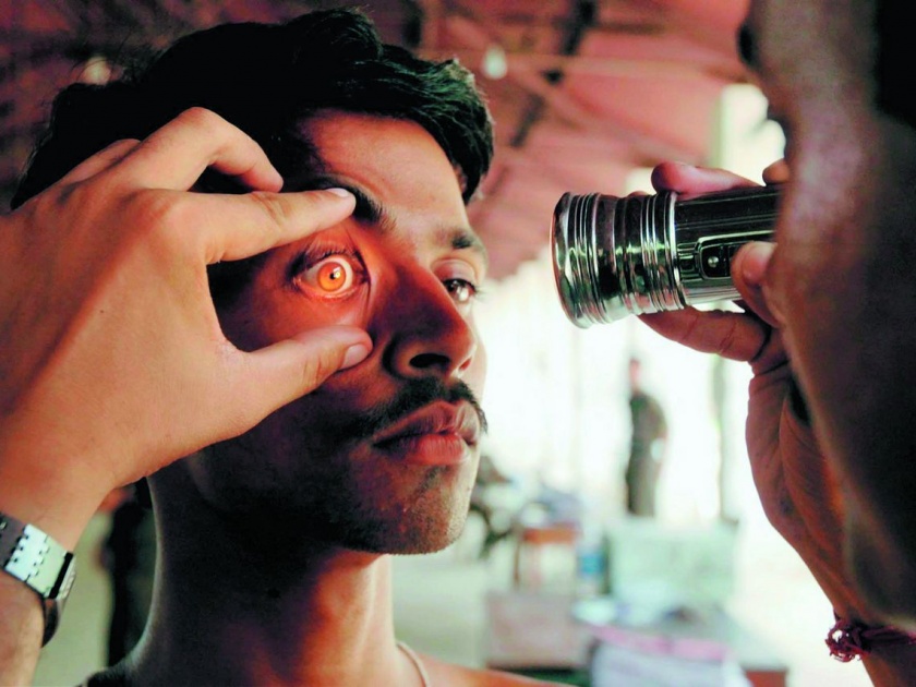 National Blindness Reduction Program fails in Vidarbha | राष्ट्रीय अंधत्व निवारण कार्यक्रमांतर्गत मोतीबिंदूमुक्त महाराष्ट्रच्या मिशनला लागले विदर्भात ग्रहण