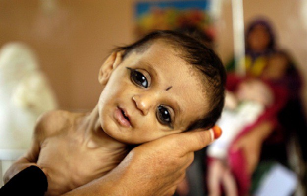 nashik,malnutrition,babies,nashik,tribal | नाशिक जिल्ह्यात अडीच हजार बालके कुपोषित