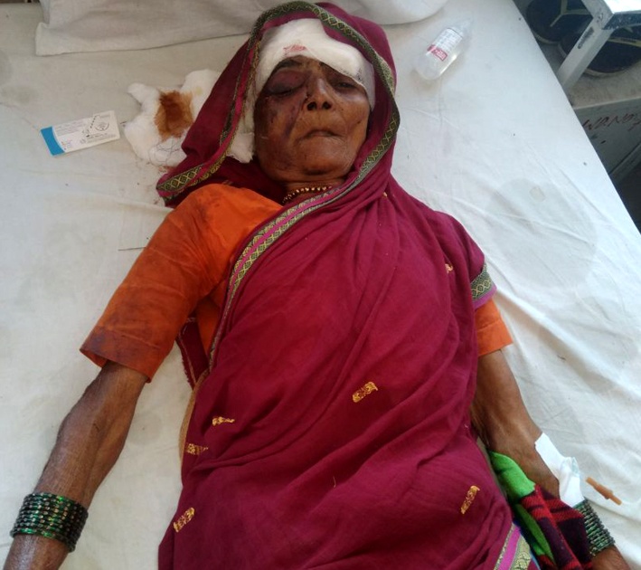 Sarpanch's mother attacked in Beed district with thieves | बीड जिल्ह्यात सरपंचाच्या आईवर चोरट्यांचा हल्ला