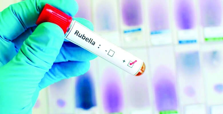 Nagpur Municipal Hospital campaign; Failure to achieve Rubella vaccination target | नागपूर मनपा रुग्णालयात मोहीम; रुबेला लसीकरणाचे उद्दिष्ट गाठण्यात अपयश