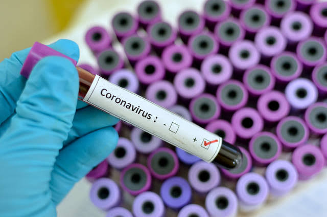 Corona virus : 31 new corona affected patients registered in Pimpri Chinchwad on Wednesday, old man dies at Dehuroad | Corona virus : पिंपरी चिंचवड शहरात बुधवारी ३१ नवीन कोरोनाबधित रुग्णांची नोंद, देहूरोड येथील वृद्धाचा मृत्यू