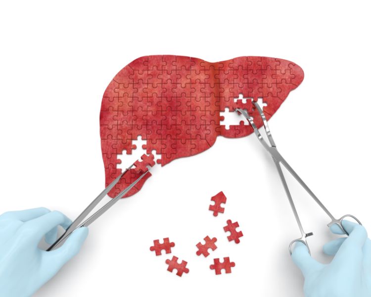 For the first time in Nagpur, liver transplant is successful | नागपुरात प्रथमच यकृत प्रत्यारोपण यशस्वी