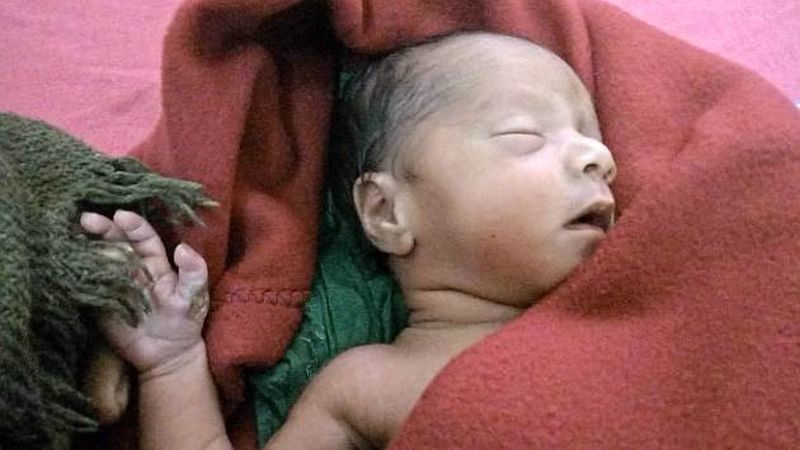 The sixth finger of the infant was cut with a blade in Melghat | अंधश्रद्धेपायी नवजात बालिकेचे सहावे बोट ब्लेडने छाटले; मेळघाटातील भीषण वास्तव