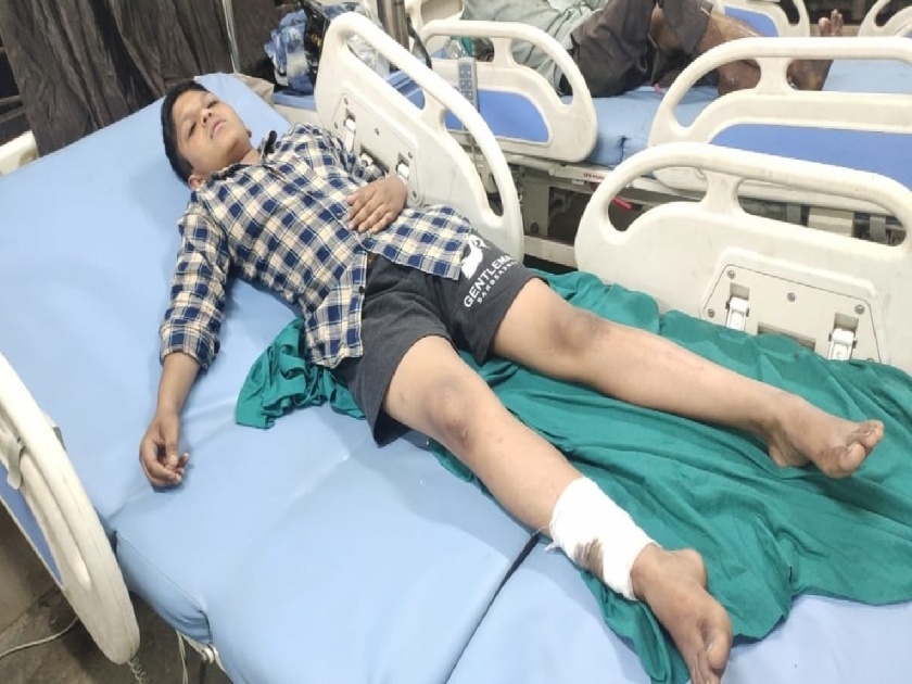 14-year-old boy attacked by 7-8 dogs in Ulhasnagar | उल्हासनगरात १४ वर्षीय मुलावर ७ ते ८ कुत्र्यांचा हल्ला, रुग्णालयात उपचार सुरू
