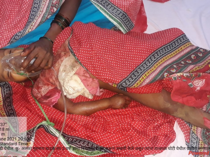 Girl killed in leopard attack in Kananwadi | काननवाडीत बिबट्याच्या हल्ल्यात बालिकेचा मृत्यू