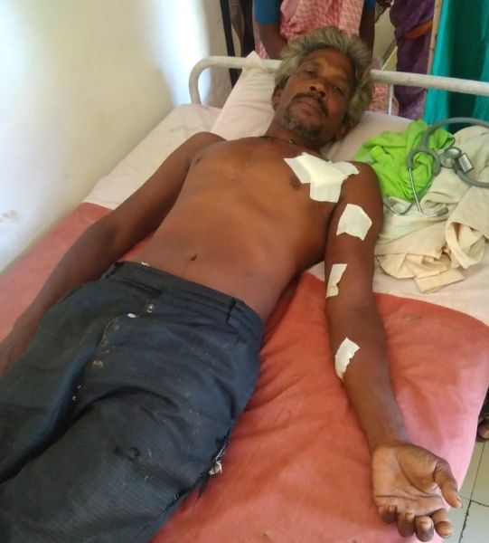 In Chandrapur district, injured in attack by tiger | चंद्रपूर जिल्ह्यात पट्टेदार वाघांच्या हल्ल्यात इसम जखमी
