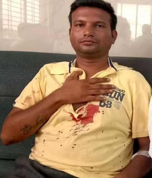 In Bhandara district, the MLA assaulted the employee | भंडारा जिल्ह्यात आमदाराने केली कर्मचाऱ्याला मारहाण