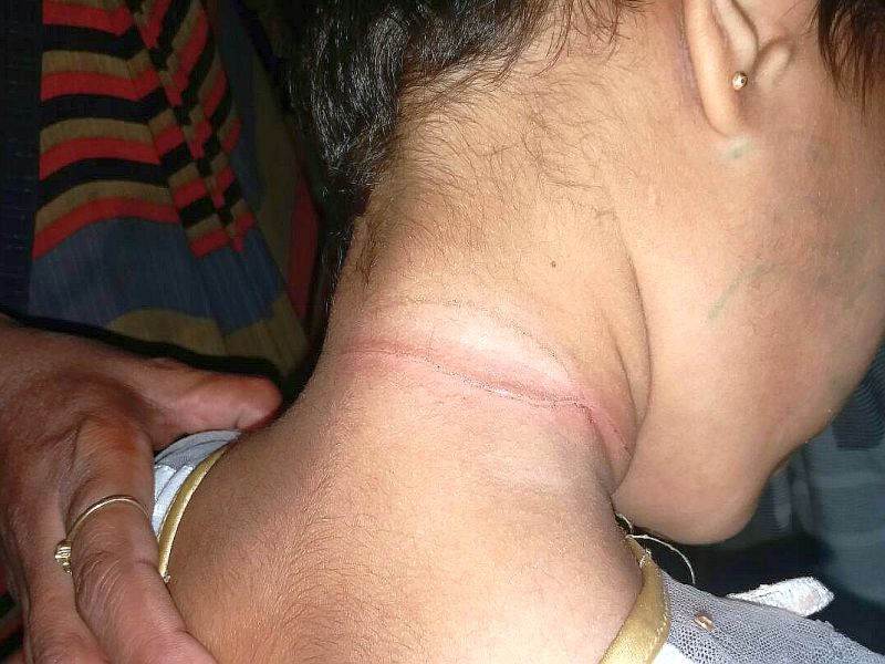 'Sankranti': Five-year-old girl has been chopped off in Nashik by Nylon | ‘संक्रांत’ : नायलॉन मांजाने पाच वर्षीय बालिकेचा नाशिकमध्ये कापला गेला गळा