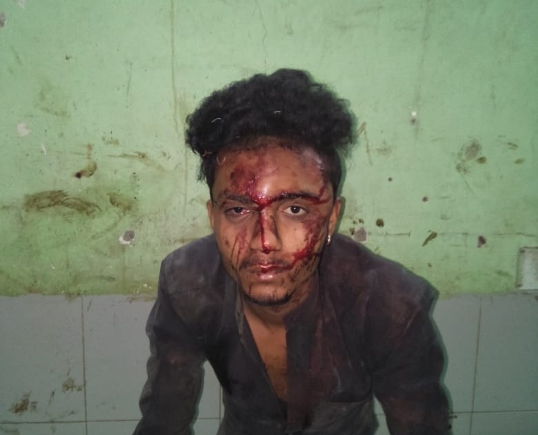 four accused beaten a young man at Gandhinagar Thane | ठाण्यात पूर्ववैमनस्यातून चौकडीची तरुणाला जबर मारहाण
