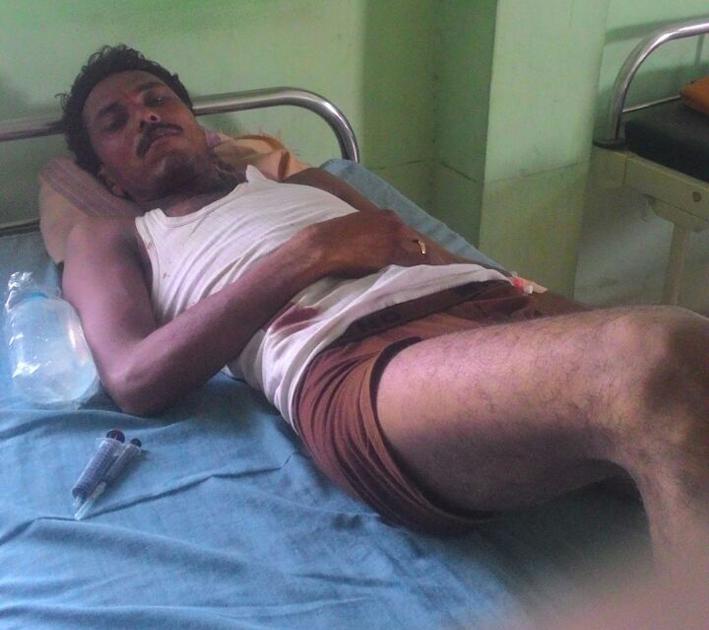 Randukar attack on cousin and nephew in Gevrai taluka | गेवराई तालुक्यात चुलता, पुतण्यावर रानडुकराचा हल्ला