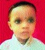 Death of Haemophilia-infected child due to lack of treatment in Aurangabad | औरंगाबादेत उपचाराअभावी हिमोफेलियाग्रस्त मुलाचा मृत्यू