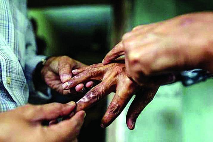 Detection of leprosy patients will go from house to house in Nagpur | नागपुरात घरोघरी जाऊन घेणार कुष्ठरुग्णांचा शोध