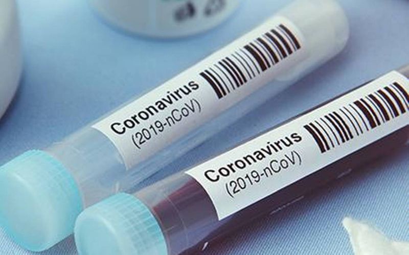 CoronaVirus; 36 new corona positive; Total number of patients 2791 | CoronaVirus; ३६ नवे कोरोना पॉझिटिव्ह; एकूण रुग्णसंख्या २७९१