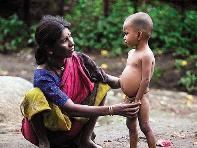 1641 children of Melghat in Amravati district have severely malnourished | अमरावती जिल्ह्यातल्या मेळघाटातील १६४१ बालके तीव्र कुपोषित