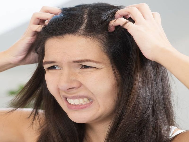 Effective home remedies to get rid of dry and itchy scalp | सतत डोकं खाजवत असल्याने झाले आहात हैराण? करा हे घरगुती उपाय