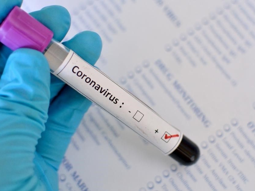 Coronavirus: In India, 194 Corona patients were found in one day; The number of coronaviruses increased pnm | Coronavirus: चिंताजनक! भारतात एका दिवसात कोरोनाचे १९४ रुग्ण आढळले; कोरोनाग्रस्तांची संख्या वाढली