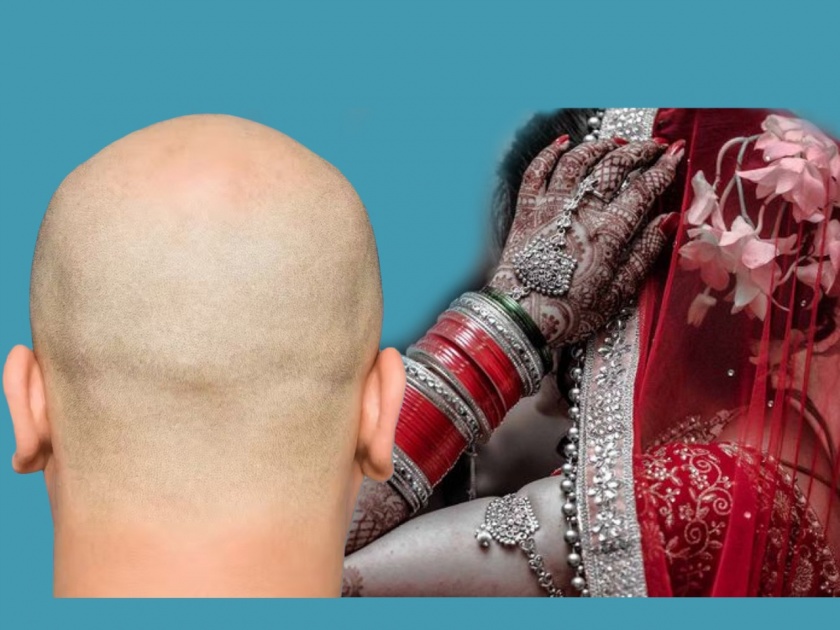 Bride refused to marriage with head shave groom after wedding function in Unnao | नवरदेव चक्कर येऊन पडला अन् त्याचा विग मेहुण्याच्या हातात आला, नवरीने लग्नास दिला नकार