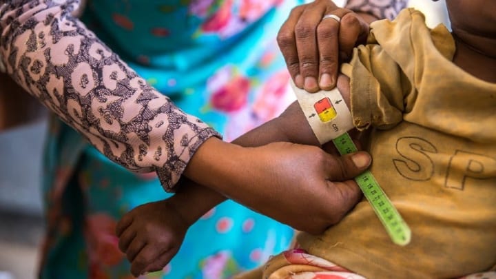 No system for screening malnourished children! | कुपोषित बालकांच्या स्क्रीनिंगला यंत्रणेची ‘ना’!