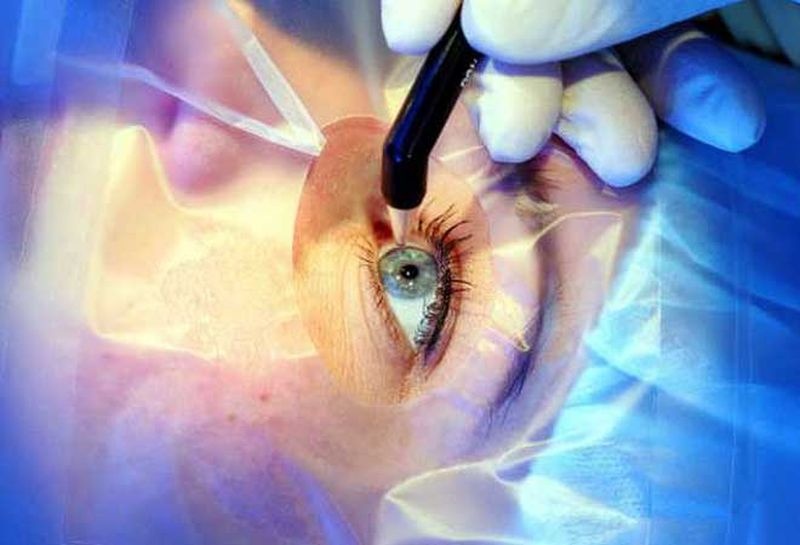 Eye surgery stalled, darkness in front of more than 600 seniors | डोळ्यांच्या शस्त्रक्रिया ठप्प, ६०० पेक्षा जास्त ज्येष्ठांसमोर अंधार