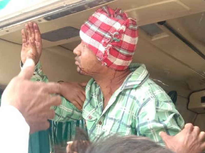 Young man injured in raid The incident in Akole taluka was taken by ear | बिबट्याच्या हल्ल्यात तरुण जखमी; अकोले तालुक्यातील घटना, कानाला घेतला चावा