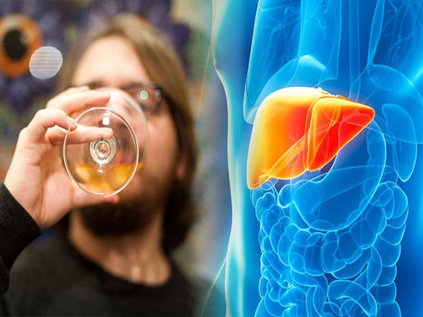 Know the detail about alcohol related liver disease | अल्कोहोलमुळे होणाऱ्या आजारांची ही आहेत ८ लक्षणे, वेळीच ओळखाल तर फायद्यात रहाल... 