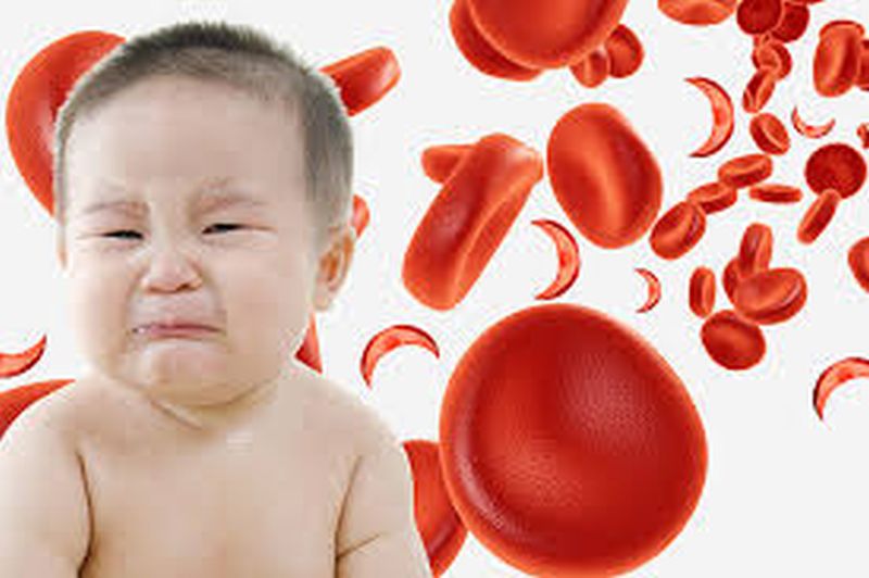 Two-year-old childrens battles with anemia! | दोन वर्षाआतील बालकांचा अ‍ॅनिमियाशी लढा!