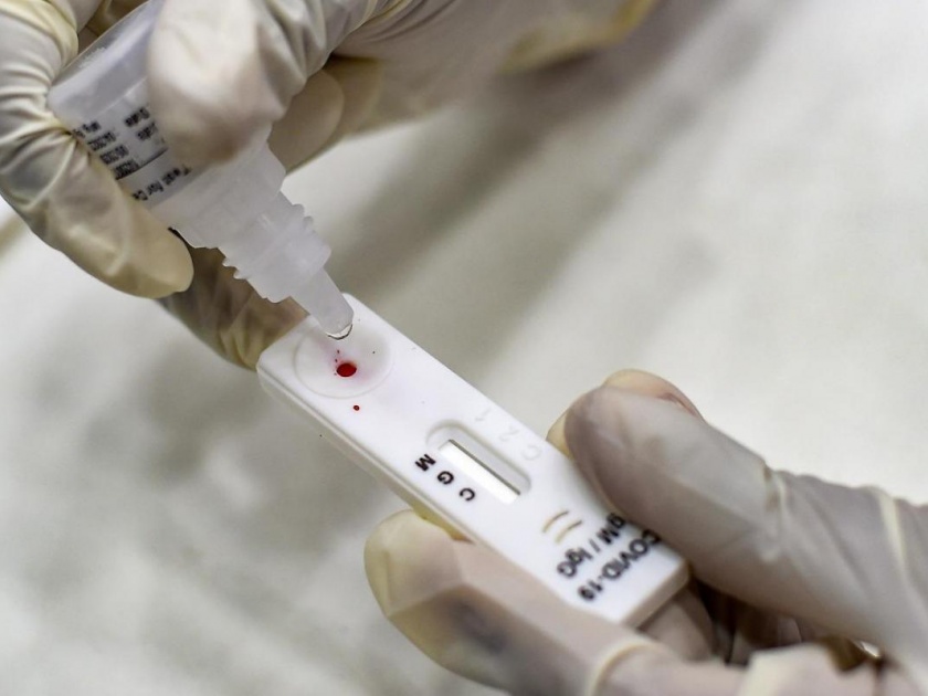 Demand for introduction of antigen test in health center | आरोग्य केंद्रात अँटिजेन टेस्ट सुरू करण्याची मागणी