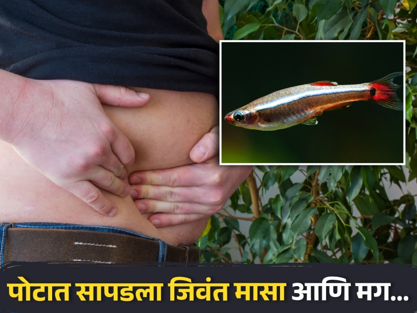 Live 12 inch eel removed from mans abdomen after pain due to peritonitis diseases | पोटात दुखत होतं म्हणून डॉक्टरांकडे गेला, पोटात सापडला जिवंत मासा आणि मग...