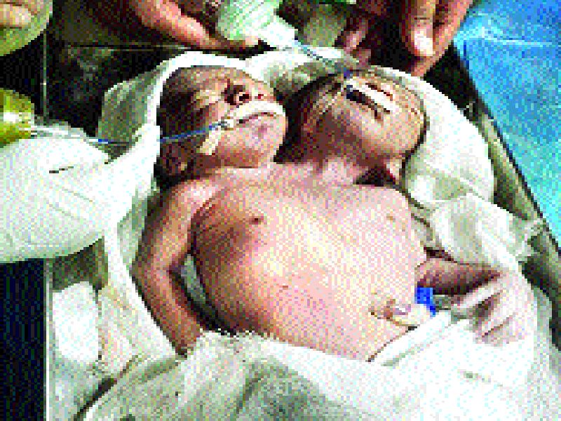 The two-headed baby died in 24 hours, the incident in Beed | दोन डोक्यांचे बाळ २४ तासांतच दगावले, बीडमधील घटना