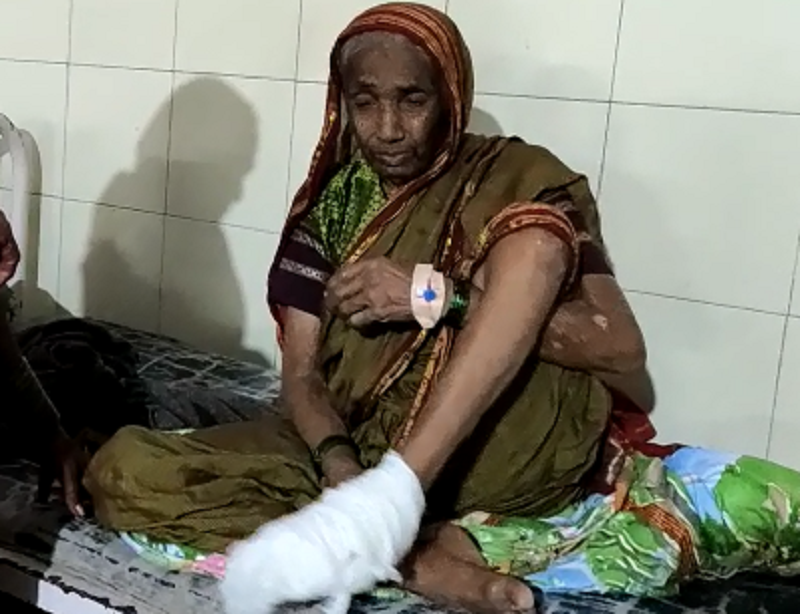 Larvae in elderly womens feet who receiving treatment at Beed District Hospital | बीड जिल्हा रुग्णालयात उपचार घेणाऱ्या वृद्धेच्या पायात अळ्या