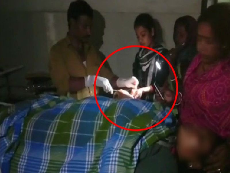 VIDEO: A woman is operated upon in torch light at Sadar Hospital | VIDEO : सरकारी रुग्णालयात टॉर्चच्या प्रकाशात ऑपरेशन