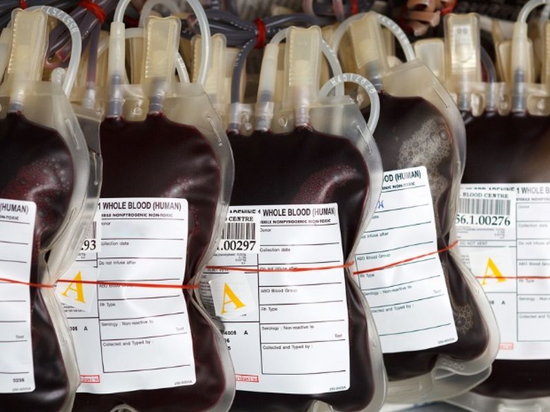 Sickle cell, thalassemia patients need 150 bags of blood per month | सिकलसेल, थॅलेसेमिया रुग्णांना महिन्याला हवे १५० बॅग रक्त