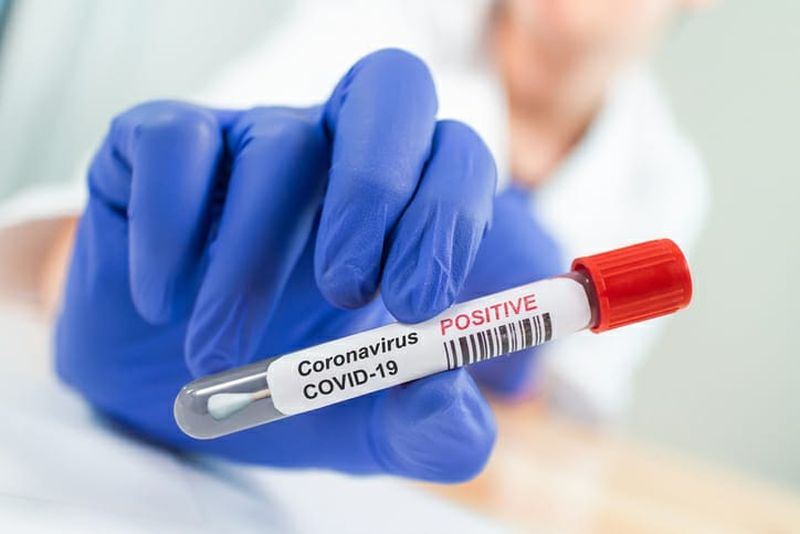 CoronaVirus in Akola: 36 more positive; The total number of patients is 663 | CoronaVirus in Akola : आणखी ३६ पॉझिटिव्ह; एकूण रुग्णसंख्या ६६३ वर