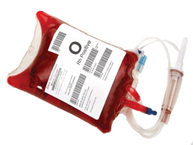 Shocking Blood Bank gave expired blood bag to patient | धक्कादायक ! ब्लड बॅंकेने दिली एक्स्पायरी डेट संपलेली रक्ताची पिशवी