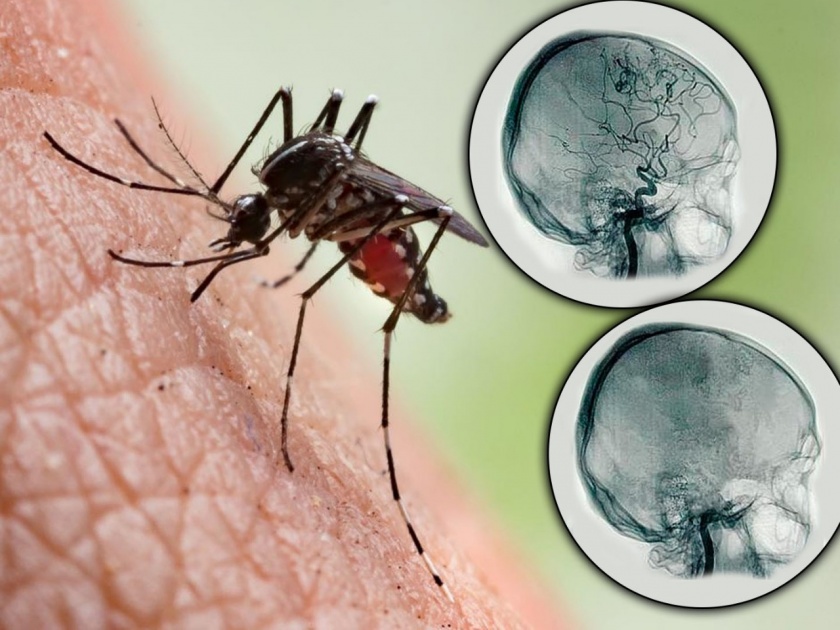 EEE mosquito borne virus cases michigan man brain dead 9 days | डासांमुळे उद्भवणारा 'हा' व्हायरस 9 दिवसांत करू शकतो 'ब्रेन डेड'; वेळीच सावध व्हा