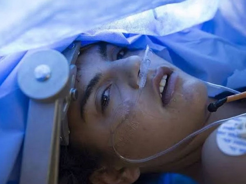 Girl undergoes brain surgery on facebook live first time in history | Video : बेशुद्ध न करता केली तरूणीची ब्रेन सर्जरी, लोकांनी फेसबुकवर पाहिली लाइव्ह!