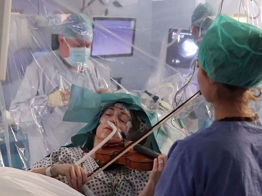 Viral Video : Woman plays violin during brain surgery to remove tumor | आश्चर्य! ब्रेन ट्यूमरची सर्जरी सुरू असताना 'ती' चक्क वाजवत होती व्हायोलिन, व्हिडीओ व्हायरल!