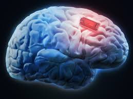 a live Neuralink brain-chip device | मगर कोई ब्रेन भी पढा है? - आता मेंदू वाचता येणार!