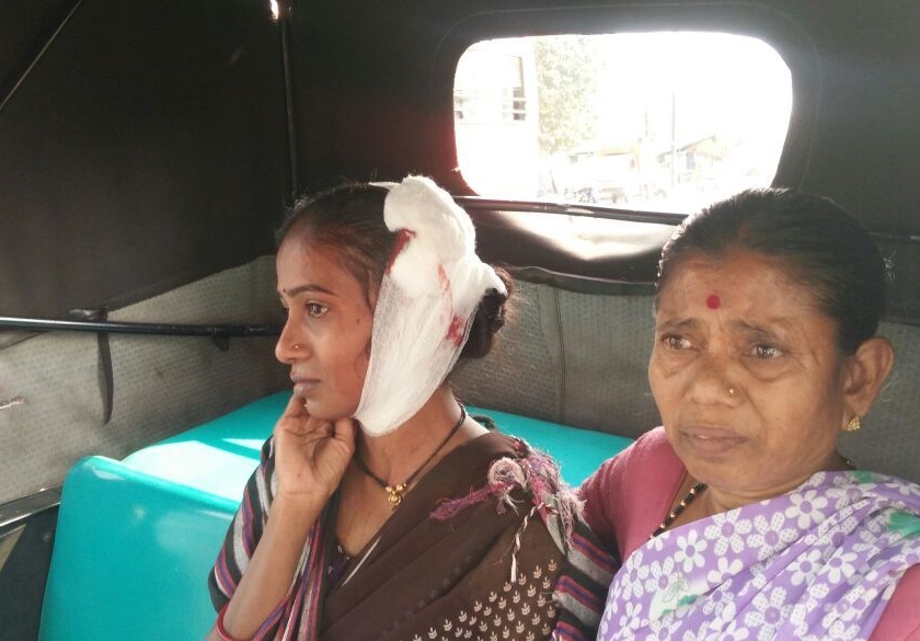 Stray bull rampaged injured Woman at Rameshwar in Nagpur | नागपूरच्या  रामेश्वरीत मोकाट सांडाचा धुमाकूळ : हल्ल्यात महिला जखमी