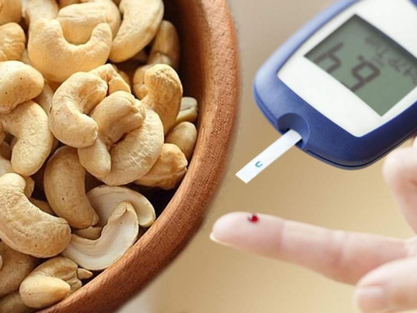 Benefits of eating cashew nuts in diabetes can a diabetic person eat cashew nuts | डायबिटीस असणाऱ्या व्यक्तींनी काजू खाणं फायदेशीर ठरतं का?