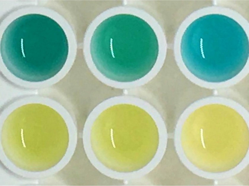 Color-Changing Urine Test Could Help Detect Cancer | लघवीच्या रंगावरून कळेल कॅन्सर आहे की नाही, निळा रंग झाल्यास 'या' कॅन्सरचं निदान!