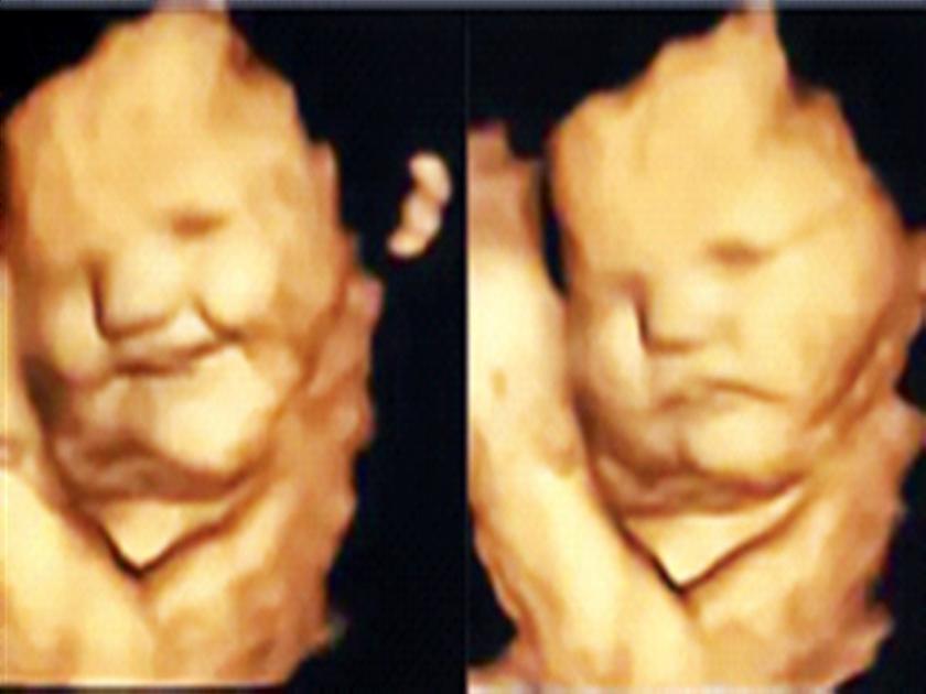 The baby in the womb laughs and gets angry too... | गर्भाशयातील बाळ हसतं आणि नाराजही होतं...