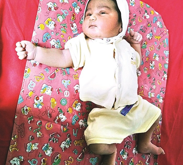 5 kg baby born in Kolhapur | कोल्हापुरात जन्मले ५ किलोचे बाळ