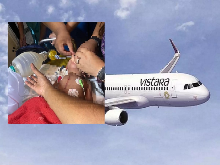 aiims-delhi-doctor-perform-surgery-in-onboard-flight-child-life-saved | उडत्या विमानात 2 वर्षीय चिमुकलीची यशस्वी हृदय शस्त्रक्रिया, एम्सचे 5 डॉक्टर बनले देवदूत