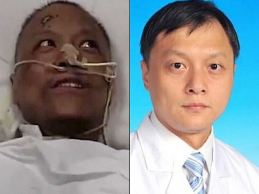Wuhan doctor whose skin changed colour from coronavirus dies kkg | CoronaVirus News: कोरोनाबद्दल जगाला सतर्क करणाऱ्या चिनी डॉक्टरच्या सहकाऱ्याचा मृत्यू; दोन महिने होते कोमात