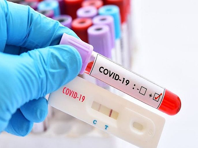 CoronaVirus usfda approves first covid 19 test kit for home use | गूडन्यूज! आता घरच्या घरी करता येईल कोरोना टेस्ट; पहिल्या सेल्फ टेस्ट किटला अमेरिकन FDAची मंजुरी