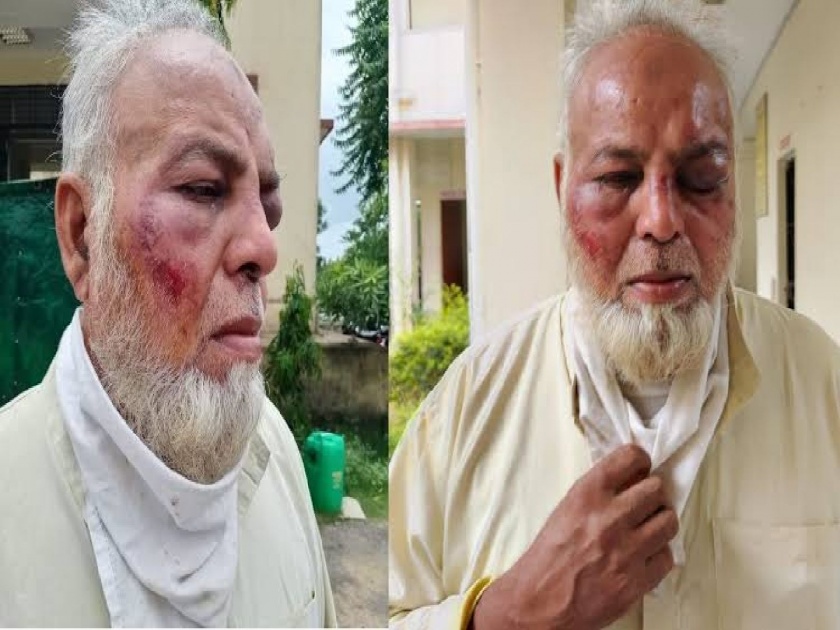 Auto Driver Beaten For Not Saying Jai- Shri Ram And Modi Zindabad In Sikar Two Arrested | मोदी झिंदाबाद अन् जय श्री राम घोषणा न दिल्यानं वृद्ध रिक्षा चालकाला बेदम मारलं; २ जणांना अटक