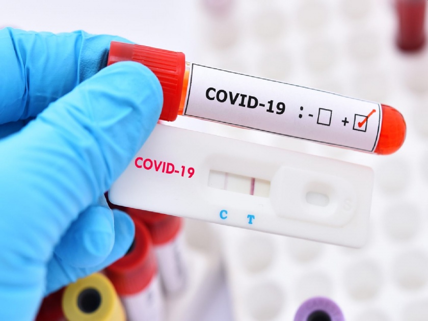 Coronavirus: Municipal to increase number of antigen tests; Purchase of 50,000 test kits | Coronavirus: महापालिका अँटिजेन चाचण्यांची संख्या वाढविणार; ५० हजार टेस्ट किट खरेदी