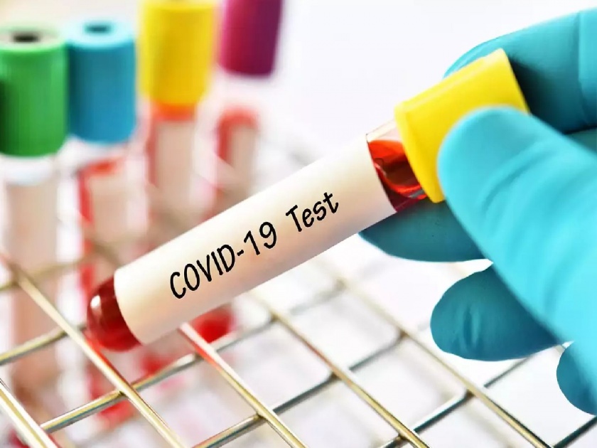 Coronavirus: Negative Report Of Covid 19 in 2500 Rupee Health Department Set Up Inquiry in meerut | Coronavirus: रुग्णालयाची धक्कादायक ऑफर; २५०० रुपयांत कोरोनाचा निगेटिव्ह रिपोर्ट मिळेल