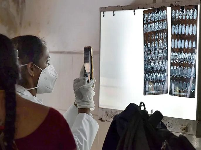 White fungus intestine case in sir ganga ram hospital Delhi | धोका वाढला! व्हाइट फंगसमुळे महिलेच्या आतड्यांना पडले छिद्र, देशात आढळली जगातील पहिलीच केस